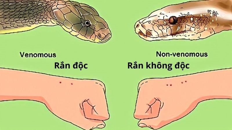 Phát triển công cụ xác định được chủng loại rắn độc cắn