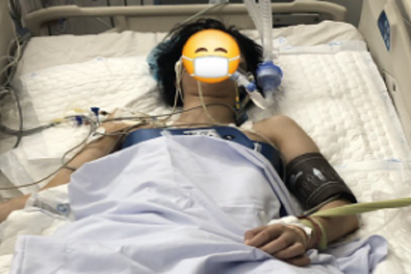 Nữ sinh 18 tuổi bất ngờ ngưng tim, ngưng thở khi tập văn nghệ