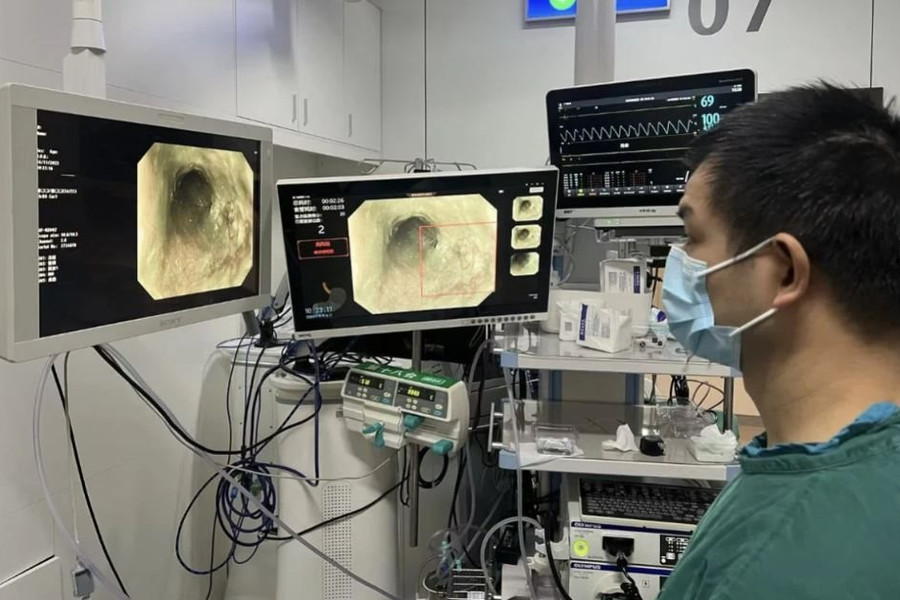 AI giúp tăng tỷ lệ phát hiện ung thư thực quản giai đoạn đầu, bệnh nhân có khả năng sống sót cao hơn