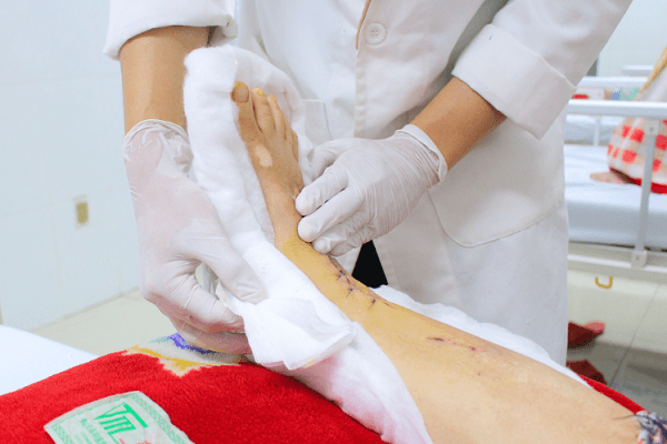 Vấp ngã khi đi bộ trong nhà, người phụ nữ 51 tuổi ở Long An bị đứt động mạch chày