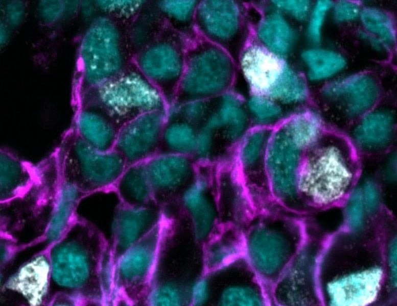 Bước tiến trong y học: Nối gene phụ làm 'tê liệt' các loại ung thư