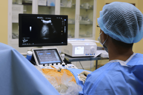Xơ gan nặng thoát khỏi u gan: TACE & RFA đổi mới điều trị