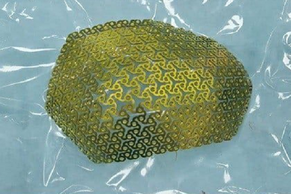 'Mảnh ghép hoàn hảo' từ Titanium: Công nghệ 3D tạo bước ngoặt trong tái tạo hộp sọ