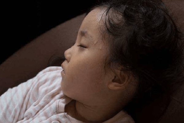 Thiếu canxi ở trẻ: Những tín hiệu ngầm nhiều cha mẹ bỏ lỡ