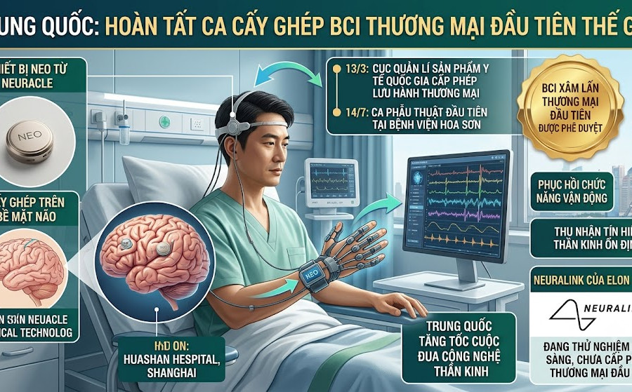 Trung Quốc hoàn tất ca cấy ghép giao diện não - máy tính thương mại đầu tiên thế giới